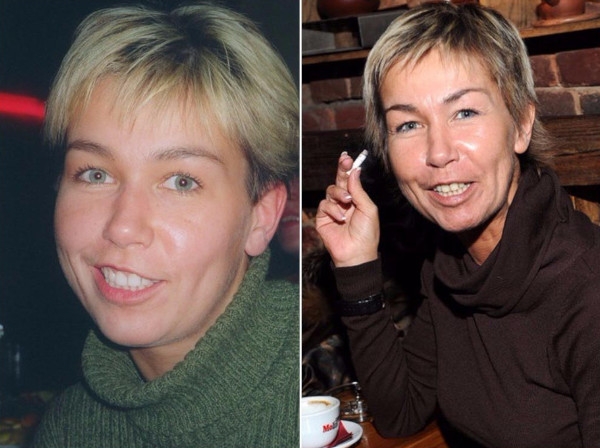 Ксения Стриж. Фото до и после пластики, в молодости, сейчас