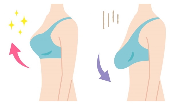 Методы подтяжки груди. Виды операции, как делается, фото до и после
