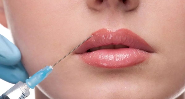 Силиконовые губы. Фото, форма, большие, красивые. Цена, отзывы
